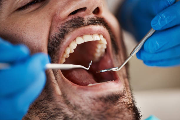 Best Knocked-Out Tooth Emergency  in West Lealman, FL